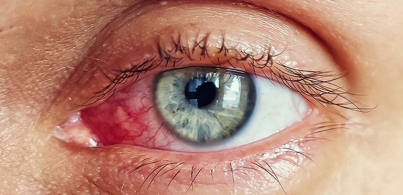 olho-seco-banners-noticias-412x200